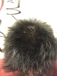 地肌が少し透けてるけどこれは短髪なのかハゲてるのかどっちかわか Yahoo 知恵袋