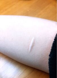 閲覧注意小学六年生から中一にかけてリスカをしていました 親や友達にバレるの Yahoo 知恵袋