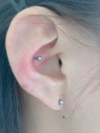 はじめまして 昨日 軟骨用のピアッサーでインナーコンクを開けまし Yahoo 知恵袋