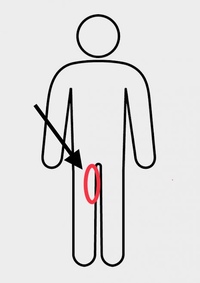 はじめまして 男子高校生です 体操初心者の者なんですが 柔軟をしていて右腿 Yahoo 知恵袋