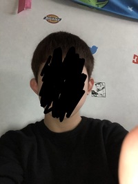 立ち耳ですごく悩んでいます恥ずかしいです手術以外で治す方法とかあ Yahoo 知恵袋
