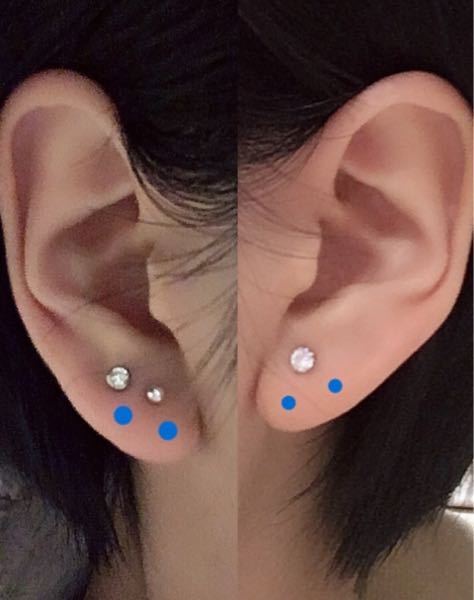 ピアスを開けたのですが、位置が上すぎました。フォローとして青
