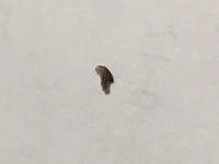 お腹の皮膚のあたりにこんなものがうまっていたんですけどなんだか分かりますか Yahoo 知恵袋