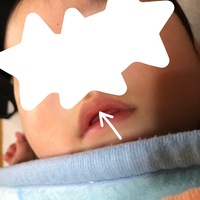 赤ちゃんの口の形について５ヶ月の息子がいます 口の形が可愛いです 上唇が Yahoo 知恵袋