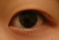 アイテープが目頭に食い込まないのですがどうしたらいいでしょうか Yahoo 知恵袋