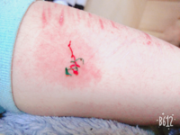 ボディステッチという自傷が止まりません中学生です ある時急に自傷を初めてか Yahoo 知恵袋