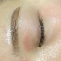 オロナイン アソコ が 痒い