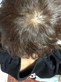 これって薄いですか ちなみに猫っ毛です Yahoo 知恵袋