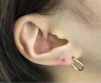 舌ピアスを開けているのですが キャッチャーが取れてしまい ピア Yahoo 知恵袋