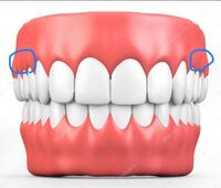 高三です 写真の青い丸らへんの歯茎から歯が生え始めました こんなところから Yahoo 知恵袋