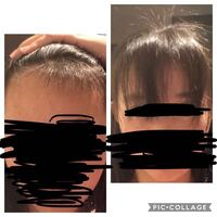 前髪の三角形 を小さくしたいです普通は上の写真のように三角形が広くて 大 Yahoo 知恵袋