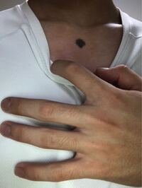 こんな大きいホクロ隠す方法ないですかね 普段は服で隠れるのですが Yahoo 知恵袋