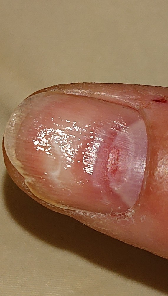 ネイリストの方に質問です 他店でやったネイルをオフしてもらっている時に Yahoo 知恵袋