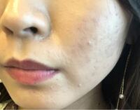 肌断食したら肌が綺麗になるってホントですか Yahoo 知恵袋