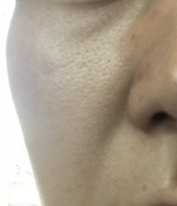 お家で簡単に毛穴の汚れをとる方法は ありますか Yahoo 知恵袋