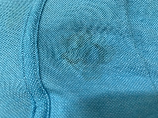 代男です 朝起きたところ パンツに黄ばみがかったシミができて Yahoo 知恵袋