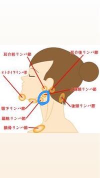 昨日の夜から青で囲ったところが少し腫れています おたふく風邪 Yahoo 知恵袋