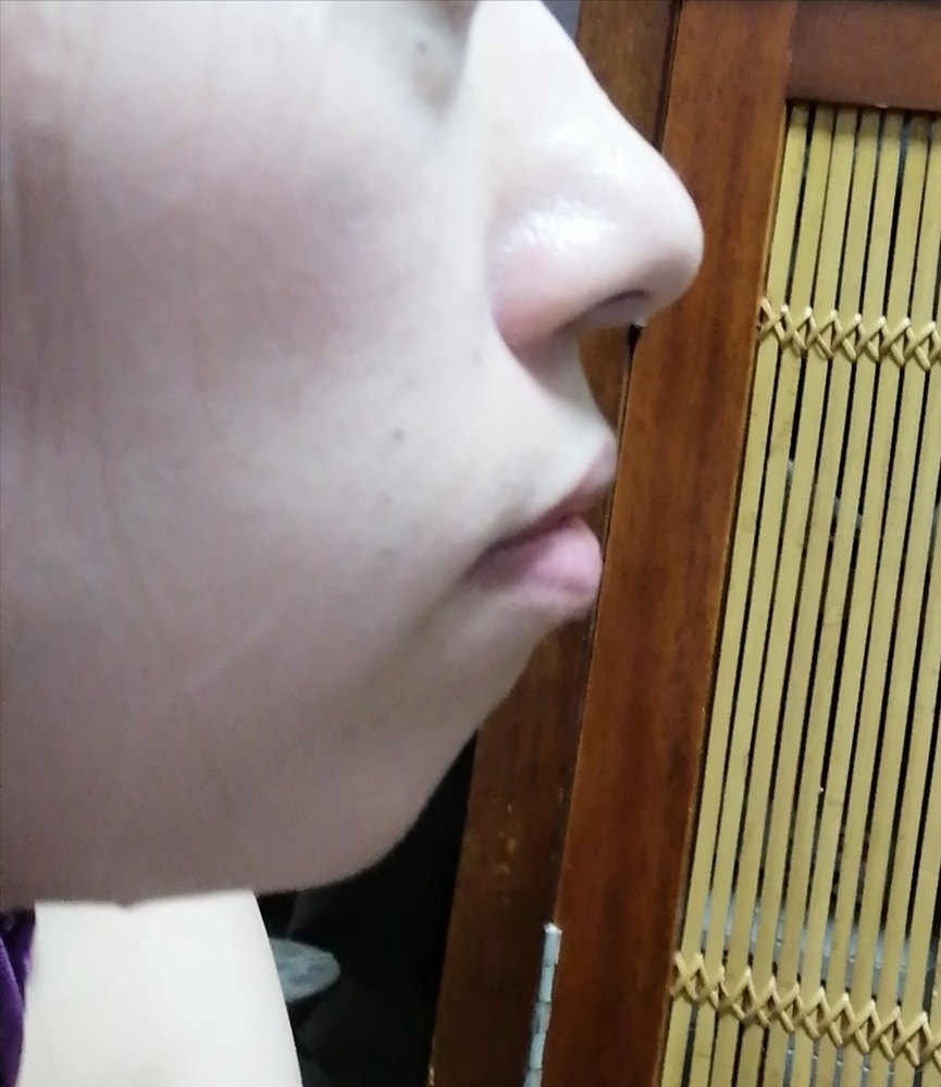 お見苦しい画像ですみません 横顔が小さい頃からコンプレックスです Yahoo 知恵袋