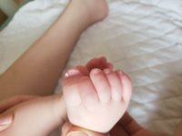 子供 6ヶ月 足の親指の爪が ささくれみたいになってます 皮膚じゃな Yahoo 知恵袋