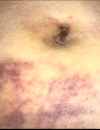 グロ画像注意です グロほどでは無いかもですが一応書いておきます Yahoo 知恵袋