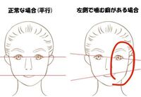 顔の歪み 噛みグセは左右どっち 顔が左右 少しずつズレて歪んでい Yahoo 知恵袋