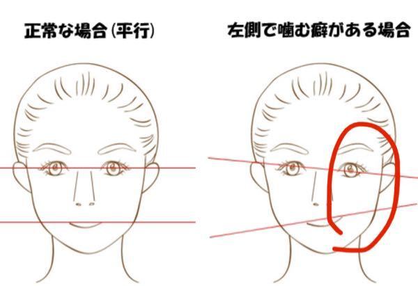 顔の歪みについて こちらの写真の左側で噛む癖があるというのは赤く囲って Yahoo 知恵袋