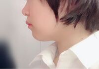 横顔なのですが 自分では鼻と顎が丸い感じで とてもコンプレックスです Yahoo 知恵袋