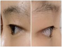 この目は出目ですか 奥目ですか 角度が違いますが左の写真が右目で 右 Yahoo 知恵袋