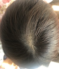 31歳女です 最近お風呂での抜け毛が酷く 排水溝に溜まる毛量も多いと感じて Yahoo 知恵袋