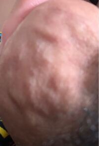 15の学生なのですがここ最近左の睾丸部に違和感があると思いつい先程見てみた Yahoo 知恵袋