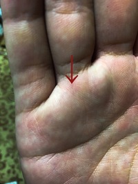 手相に詳しい方にお聞きします これは 俵紋と言われる手相でしょうか Yahoo 知恵袋