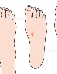 1週間ほど前 朝起きたら足の甲に赤い虫刺され のようなものができていて 足首が痛 教えて 住まいの先生 Yahoo 不動産