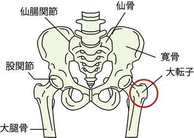 大転子 骨盤ベルト に関するq A Yahoo 知恵袋