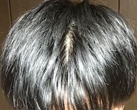 現役大学生です 後頭部の髪の毛がパックリ割れます くしでとくと直り Yahoo 知恵袋