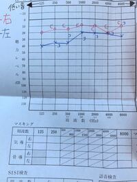 見方 結果 聴力 検査