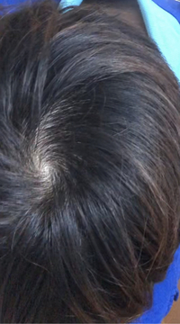 つむじの位置について 私のつむじは画像の矢印のところなんですけど後ろす Yahoo 知恵袋