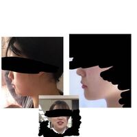 顔やせに成功した人いますか 痩せる順番は ある程度あるとは思いますが顔 Yahoo 知恵袋