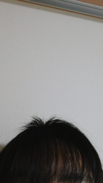 Daisoのヘアーカッターを使って切ったら やらかしました カッパにな Yahoo 知恵袋