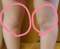 皆さんは膝回り何センチですか 153センチで36センチは太いですかね あと出来 Yahoo 知恵袋