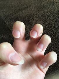 爪の形が汚くて悩んでます 今までは校則がゆるく 爪を伸ばして形を誤魔 Yahoo 知恵袋