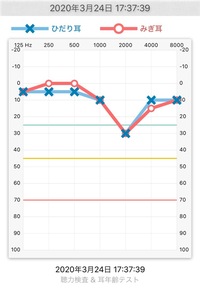 騒音性難聴の場合 聴力検査では4000hzのv字が一般的だと思いますが Yahoo 知恵袋
