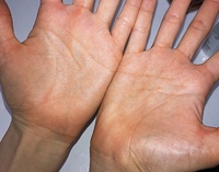 手相についてです 右手に頭脳線と生命線の間に大きな十字が出来 Yahoo 知恵袋