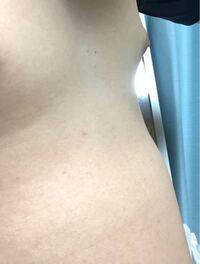 男子高校生です これは女性化乳房ですか 小学生の頃は肥満体型でした今 Yahoo 知恵袋