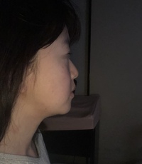 横顔が不細工350万ほど整形して正面顔は少しましになったかと思いますが横顔 Yahoo 知恵袋