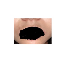 まだ中学生なのにｼﾐが沢山ありますこのｼﾐ消えませんかね 私は顔に沢 Yahoo 知恵袋