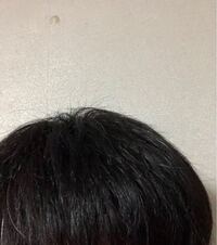 写真あり 男です髪の毛の跳ねてる部分 写真で言う髪型からはみでてる部分 Yahoo 知恵袋