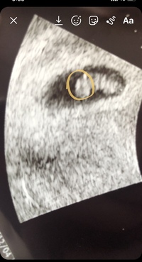 現在妊娠8週目です 妊娠7週目で初受診し心拍確認 Crl5 9mmでした Yahoo 知恵袋