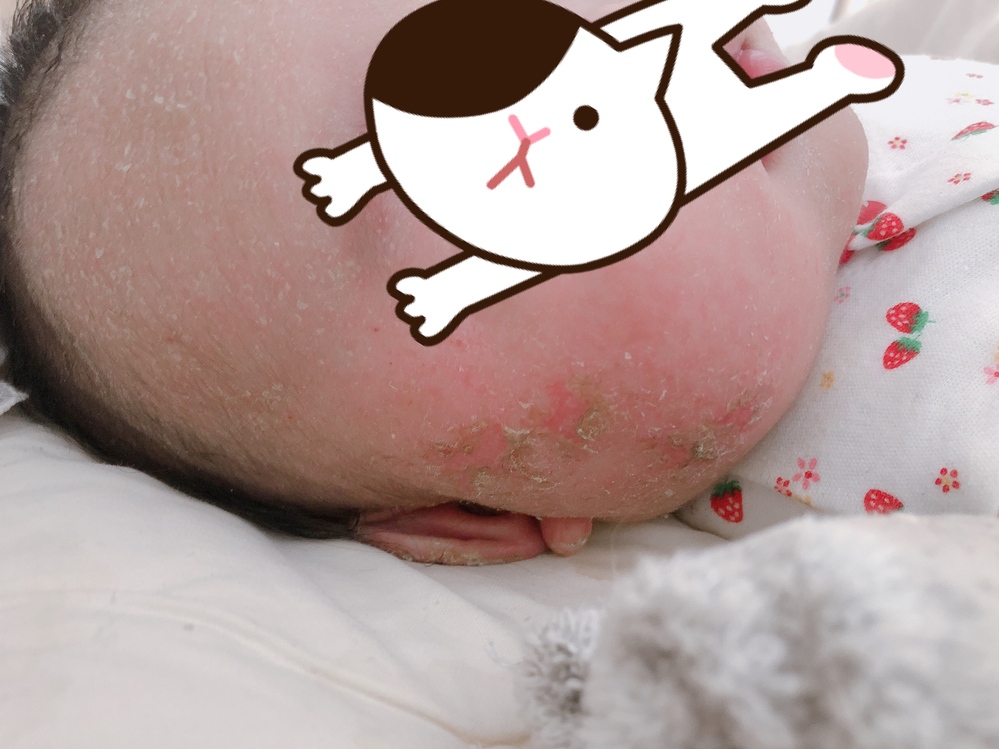 子どもの病気とトラブル 解決済みの質問 Yahoo 知恵袋