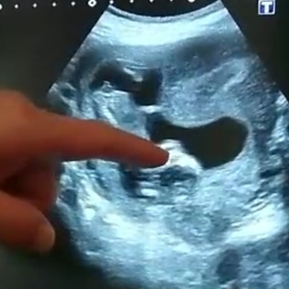 現在 妊娠13週目でこの間超音波検査をしたのですが おまたの辺り Yahoo 知恵袋