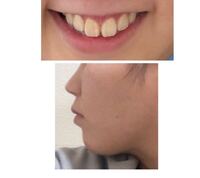 ミスミソウを最近になって見たのですがたえちゃんは主人公のこと Yahoo 知恵袋